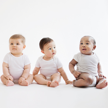Apakah Bayi Anda Berisiko Menderita Kelainan Albino?