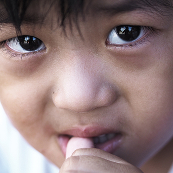 Anak Stres Menggigit Kuku, Harus Dihentikan