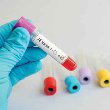 Dua Cara Ini Bisa Cegah Anak Tertular Virus Japanese Enchepalitis