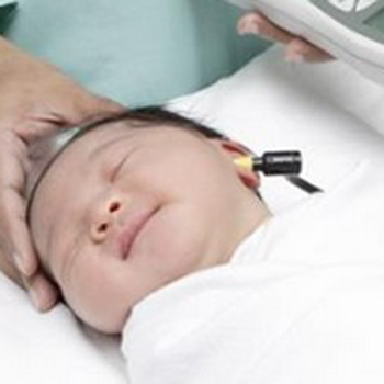 Gangguan Pendengaran Pada Bayi