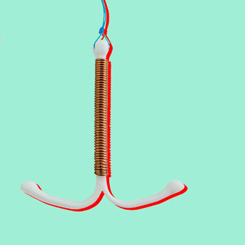 Pakai IUD Tapi Tetap Hamil