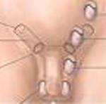 Undecencus Testis Alias Testis Kosong