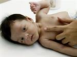 Asal Usul Kulit Bayi