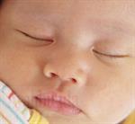 Bayi Kok Berjerawat 