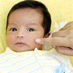 Masih Bayi Tapi Berjerawat