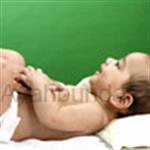 Bayi Tertular Cacar Air