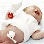 Infeksi Tali Pusat Bayi Baru Lahir