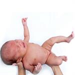 Pemeriksaan Mata Bayi Baru Lahir 