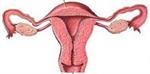 Endometriosis, Darah Haid Tidak Keluar Dan Mengendap. 