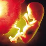 Abortus Spontan