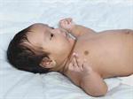 Payudara Bayi Membesar