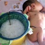 Lotus Birth