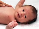 Fungsi Kulit Bayi 